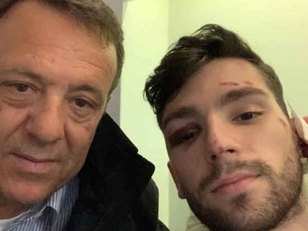 You are currently viewing Τραγωδία στα Τέμπη: «Μπαμπά, έχω εγκλωβιστεί και γύρω μου βλέπω μόνο φλόγες»